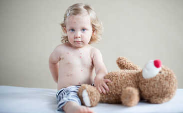 Летние высыпания у ребенка: как с ними бороться