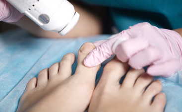 Как вылечить грибок на ногах в домашних условиях?