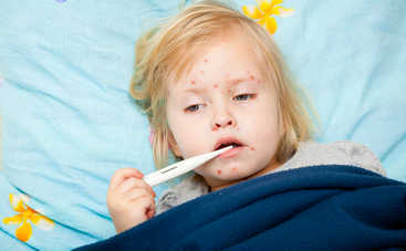 3 популярные вопроса о ветрянке: можно ли заболеть повторно и другие