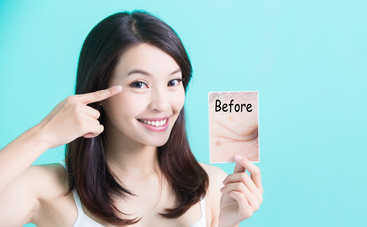 Как спасти кожу вокруг глаз: лайфхак за 5 минут