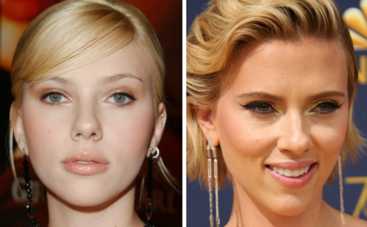 Звездные мамы, которым пластика помогла в карьере