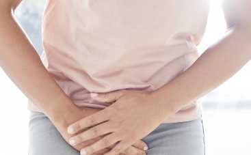 3 неожиданные причины молочницы