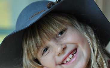 Когда у детей выпадают молочные зубы