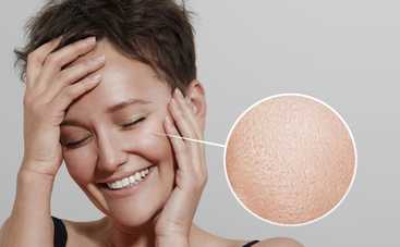 Уход за жирной кожей: главные советы