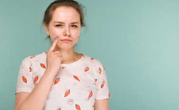 Контагиозный моллюск у детей: откуда берется и как лечить