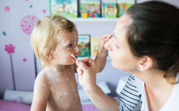 Ветрянка у детей: лучше привиться или переболеть?