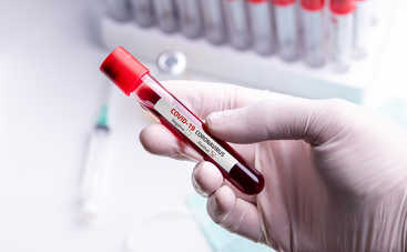 Можно ли заразиться двумя вариантами коронавируса: ответ инфекциониста