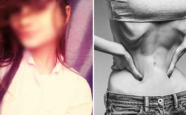 В Одессе от анорексии умерла 12-летняя девочка - комментарий психолога