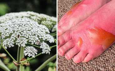 Опасная трава: покажите детям борщевик Сосновского