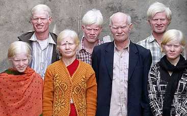 70-сантиметровая мама и 10  альбиносов-индусов : ТОП-8 самых необычных семей мира