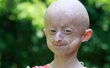 10-летняя девочка умерла от старости: сегодня хоронят Иру Химич