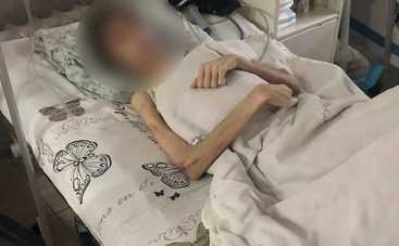 «Ему нужно духовное лечение»: в Одессе родители не давали  сыну пить и есть
