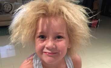 Ребенок-одуванчик: что такое «синдром нерасчесываемых волос»