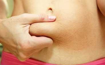 Восстановление после родов: как не навредить себе, стараясь прийти в форму?