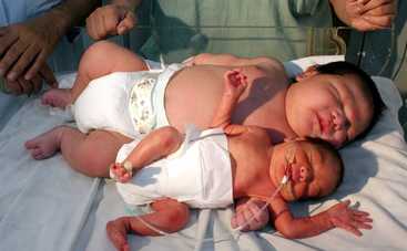 От 6 до 8 кг: самые большие новорожденные в мире