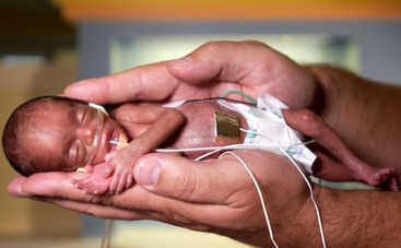 Ребенок родился на 4 месяце и выжил: как он выглядит сейчас