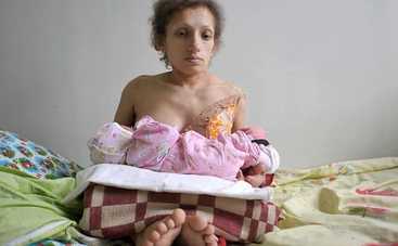 Умерла самая маленькая мама Украины Мария Украинец: история ее жизни