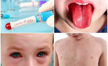 Штамм коронавируса «Дельта» чаще вызывает у детей смертельный синдром