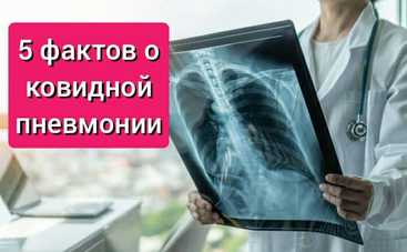Вуаль коронавируса: 5 удивительных фактов о коронавирусной пневмонии