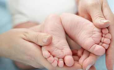 Детская косолапость: причины и лечение