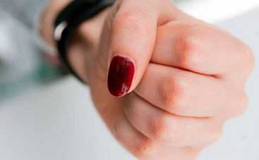 В Днепре учительница физкультуры избила двух школьников (фото)