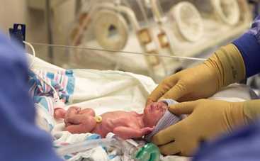 Недоношенная девочка научила маму ценить жизнь (фото)