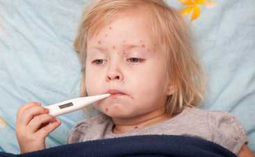 В Украине может начаться эпидемия кори