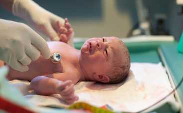 Что такое пупочная грыжа