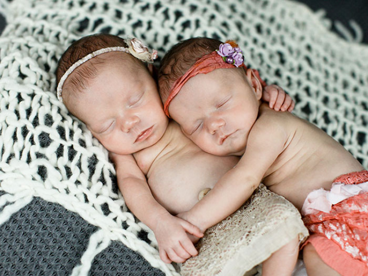 identical-twins-born-holding-hands-jenna-jillian-sarah-thistlethwaite-8_750x563
