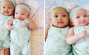 Сестры-близняшки с разным цветом кожи покорили интернет