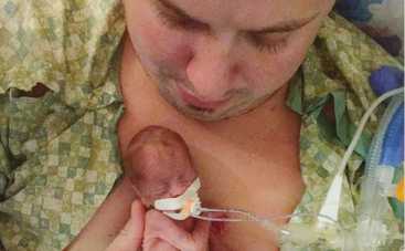 Родители выложили фото своих недоношенных детей по одной важной причине