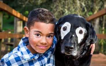 Мальчика спасла дружба с собакой с такой же редкой болезнью, как и у него