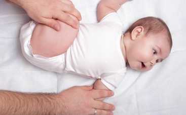 Дисплазия у новорожденных: нужно ли искать костоправа?