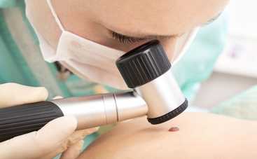 5 случаев, когда родинку нужно срочно показать врачу