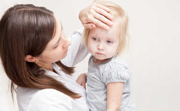 5 правил при ветрянке у ребенка: как действовать