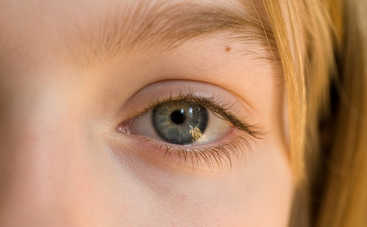 Как по родинкам на лице узнать судьбу и характер человека