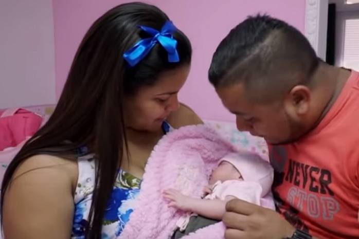 Близнец-паразит: в Колумбии родилась девочка с сиамским близнецом внутри