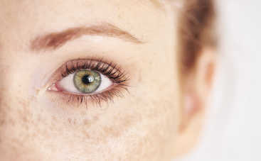 Почему появляются веснушки и пигментные пятна и как с ними бороться