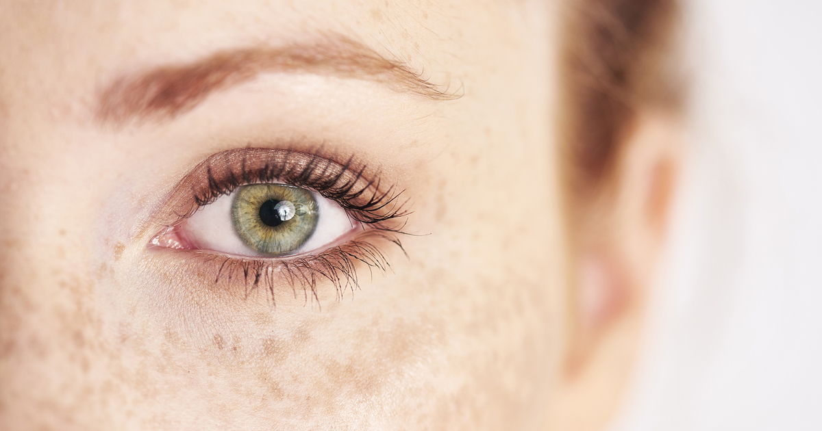 Почему появляются веснушки и пигментные пятна и как с ними бороться ...